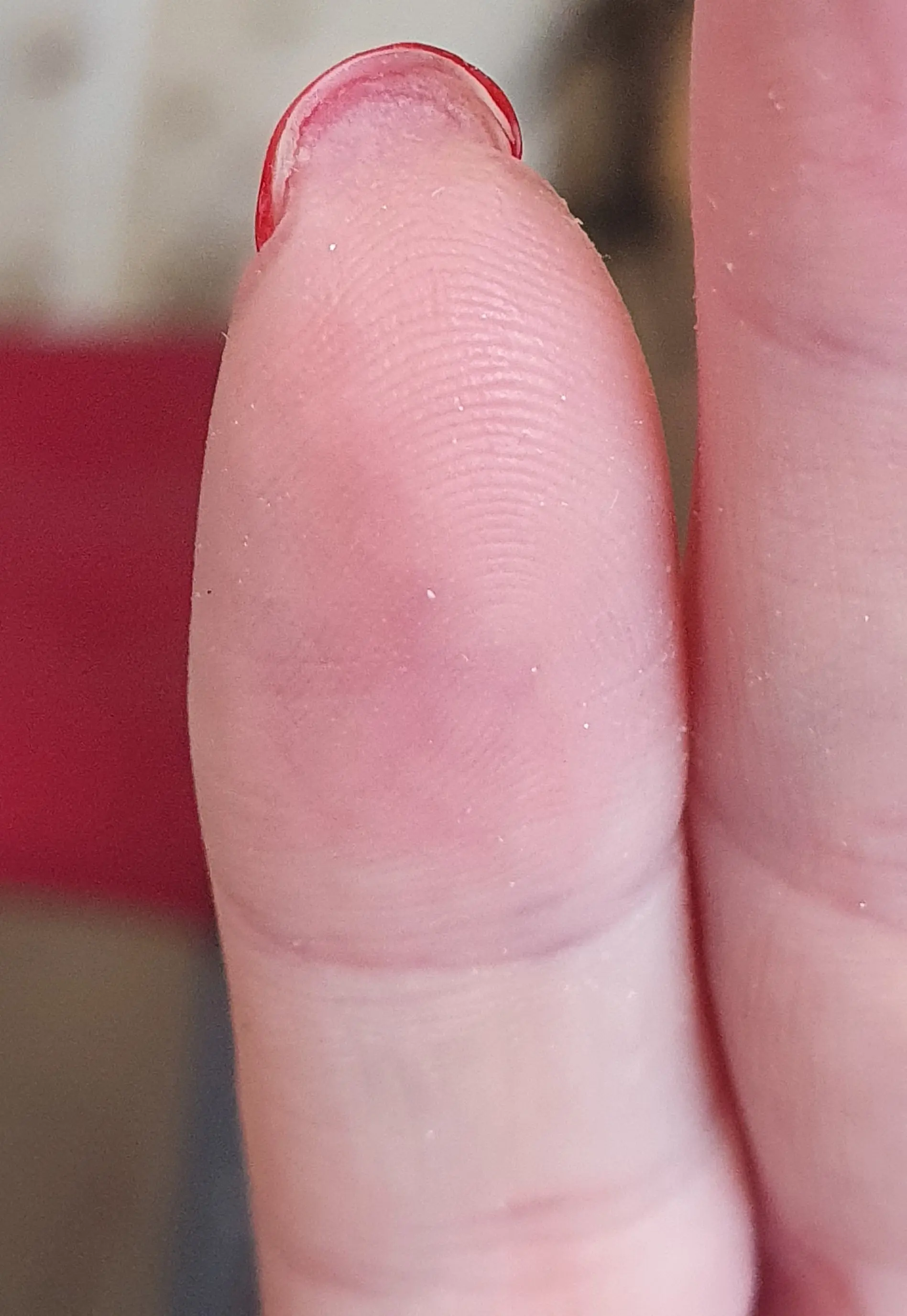 מה זה היפוניכיום?