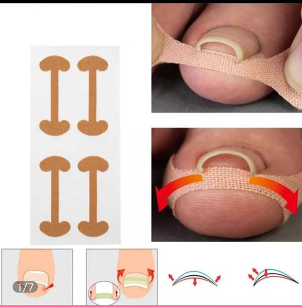מדבקות לציפורן חודרנית